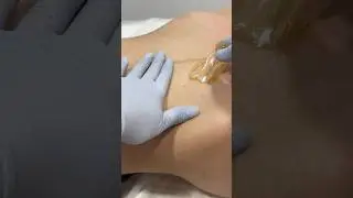 Depilation with paste 