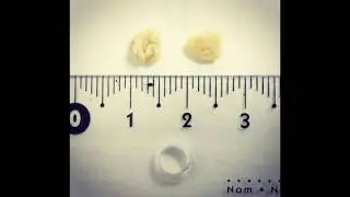 Цистотомия у кота