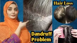 Get Rid of Hair Loss and Dandruff FAST!