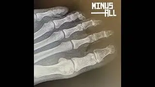 Feel it in my bones