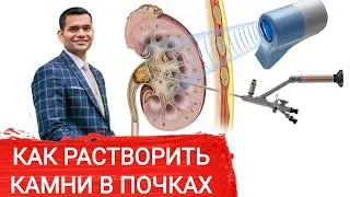 Как Растворить Камни В Почках Из Оксалата Кальция - Доктор Вивек
