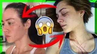 ¿POR QUÉ fue la PELEA de DIOSA CANALES con OSMARIEL VILLALOBOS? + VÍDEO COMPLETO DE LA PELEA