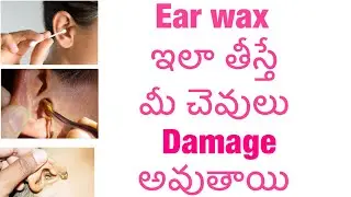 Ear wax clean చెయ్యడం ఎలా/how to clean earwax/how to clean children ears/not necessary to clean wax