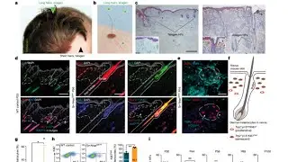 AMP303: The Cure To Hair Loss Is Here
