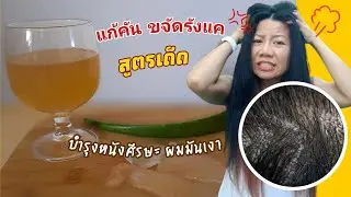 สูตรรักษารังแค แก้คันหนังศีรษะ ทำง่าย ๆ ส่วนผสม 2 อย่าง | สูตรสมุนไพรบำรุงผม | KKD diy Hair Mask