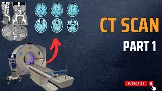 What is Computed Tomography (CT Scan) | Medical Technology