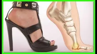 Sencillo Truco Para Usar Tacones Altos Sin Sentir Dolor En Los Pies