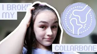I BROKE My Collarbone!