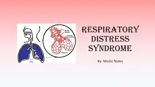 Respiratory distress syndrome - pathophysiology, clinical features, prevention, treatment