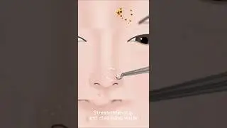 #animation