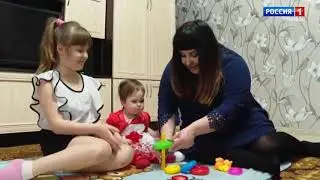 Соня Таран, 8 месяцев, врожденная деформация черепа, спасет операция