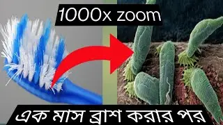 এক মাসের বেশি ব্রাশ ব্যবহার করলে কি হয় দেখুন