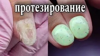 Протезирование ногтя😨 часть 3👌🏻#маникюр #красивыйманикюр #ногти