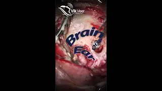 Finding the Brain in an Ear Operation (18+)