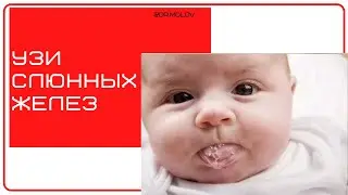 Ультразвуковое исследование (УЗИ) слюнных желез, запись вебинара.