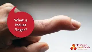 Mallet Finger Treatment