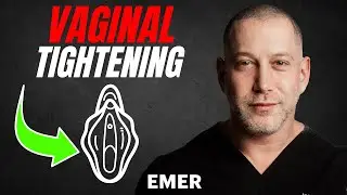 BTL ULTRA Femme 360 for VAGINAL TIGHTENING and REJUVENATION of VAGINAL CANAL | Dr. Jason Emer