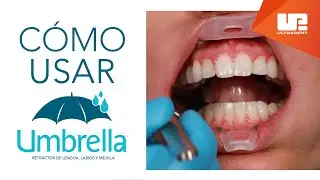 Cómo usar el retractor de lengua, labios y mejillas Umbrella™ | Step-by-Step