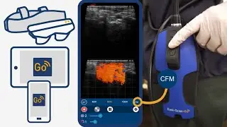 Introducing Color Doppler flow for the Easi-Scan:Go