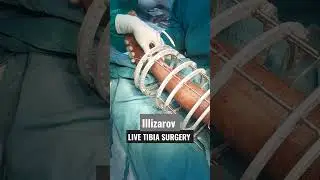 arthroscopy | orthopedics  |  Illizarov surgery