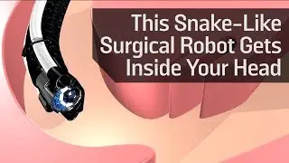 Flexible robots are ready to perform complicated surgery.