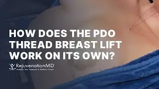 PDO Threads: A Natural Breast Lift Solution