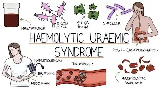 Hemolytic–uremic syndrome