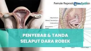 Sering Disebut Tak Perawan, Ketahui Ini Penyebab dan Tanda Selaput Dara Wanita Robek