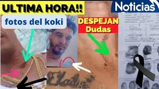🔴Gobierno FILTRA fotos cadáver KOKI⚡️ULTIMAS NOTICIAS de Venezuela Hoy