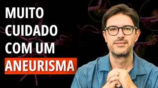 Aneurisma Cerebral  - O Que é Aneurisma Cerebral