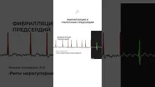❤️Видео адаптировано с английского языка. Плюс я добавил пару важных моментов