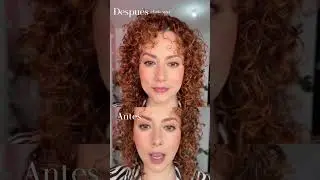 Lip injections, Beauty Creations