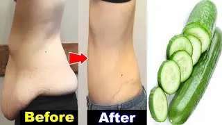 How to Lose Belly Fat in Just 30 Days Get a flat Belly at Home !! No Strict Diet - No Workout
