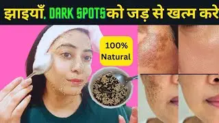 1 Week Challenge-झाइयां, दाग धब्बे,DARK SPOTS 100% गायब,पाये जादुई निखार 