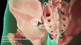 Forensic 3D Animation
