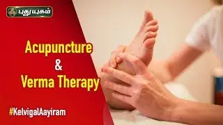 How Does Acupuncture and Varma Therapy Work? | Kelvigal Aayiram | 29/02/2020 | PuthuyugamTV