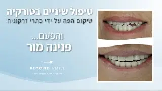 טיפולי שיניים בטורקיה עם ביונד סמייל - שיקום מלא בטורקיה של פנינה