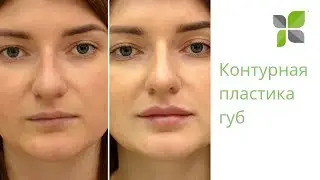 Контурная пластика губ в NewSkinClinic