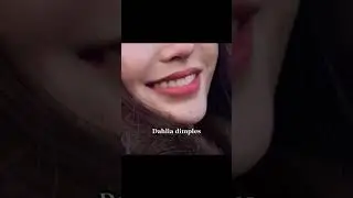 Types of dimples 