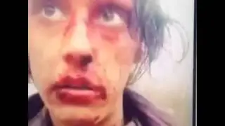 Усы выщепал))) Пипец