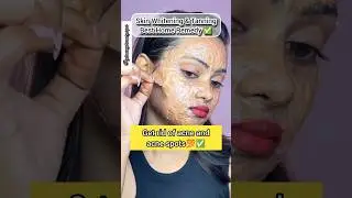 🔥Best facemask for clear and glowing skin💯Skin whitening and tan removal facepack✅👌#shorts#ytshorts