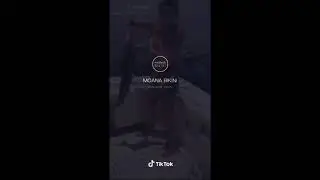 Bikini navel show | wardrobe malfunction | bra stripped