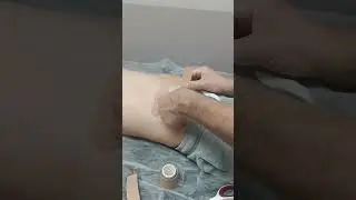 Пупочная грыжа у детей.