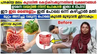 വയറ്റിൽ നിന്ന് പോകാതിരിന്നാൽ ഉണ്ടാകുന്ന പ്രശ്നങ്ങളും പരിഹാരങ്ങളും| CONSTIPATION|malabhandham
