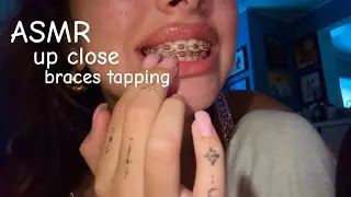 ASMR up close braces tapping ( mix mouth sounds )