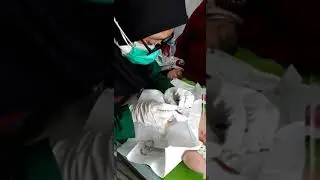 Pemasangan Kateter Umbilical pada Bayi