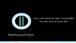Types of Valves