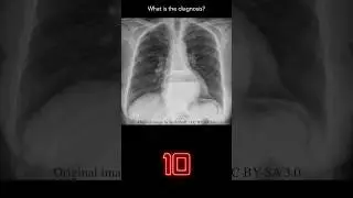 Chest X-ray Quiz 2 (explanation with overlays)