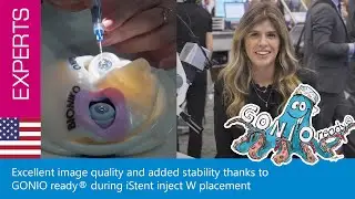 Excellent image quality and added stability thanks to GONIO ready® during iStent inject W placement