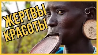 Страшная красота: жертвы, на которые пошли женщины ради красоты и моды